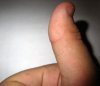 большой палец правая рука 2.jpg