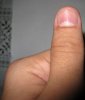 большой палец левая рука 1.jpg