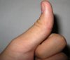 большой палец левая рука 2.jpg