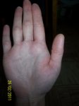 100_2515.JPG