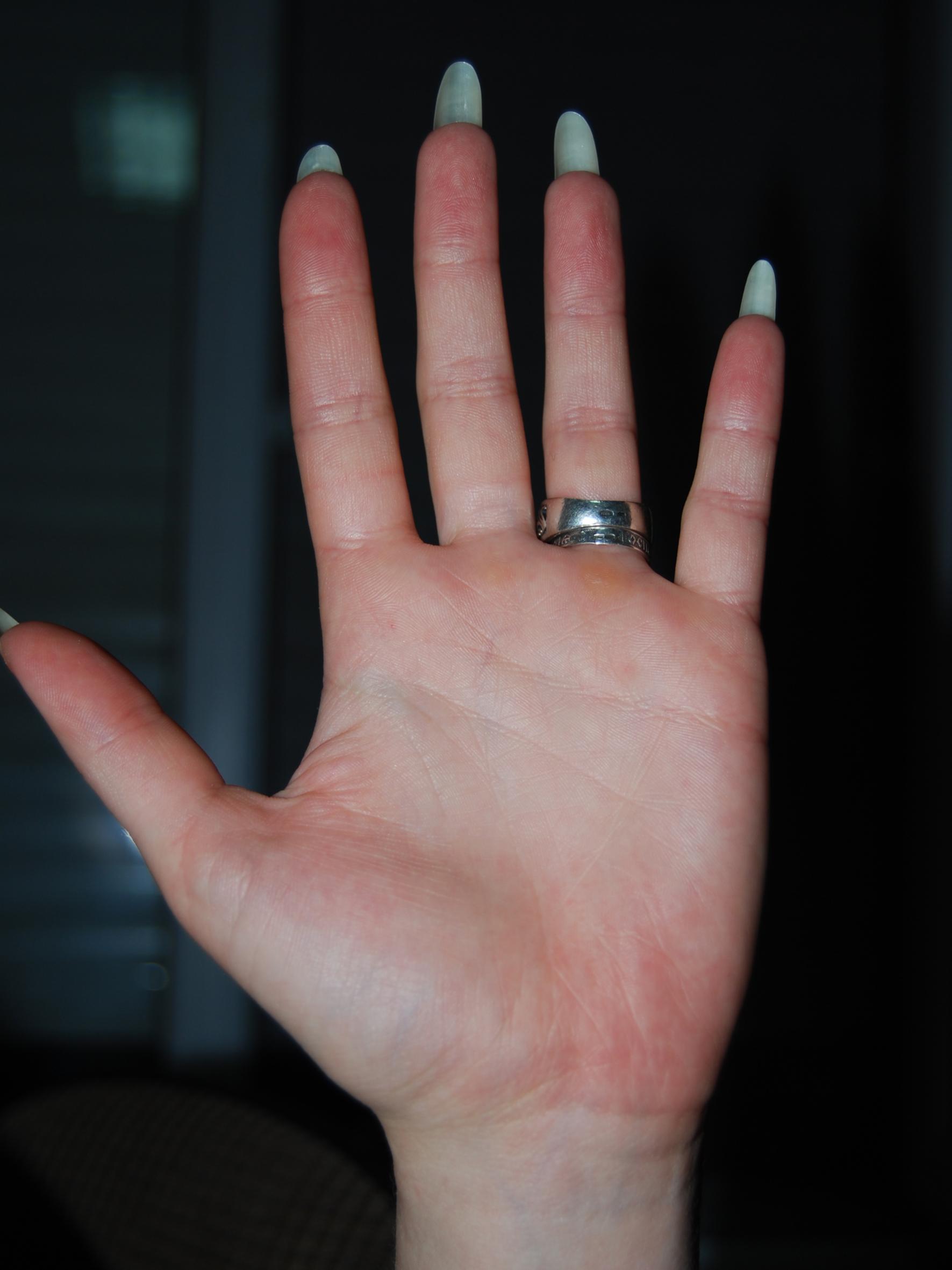 левая рука.jpg