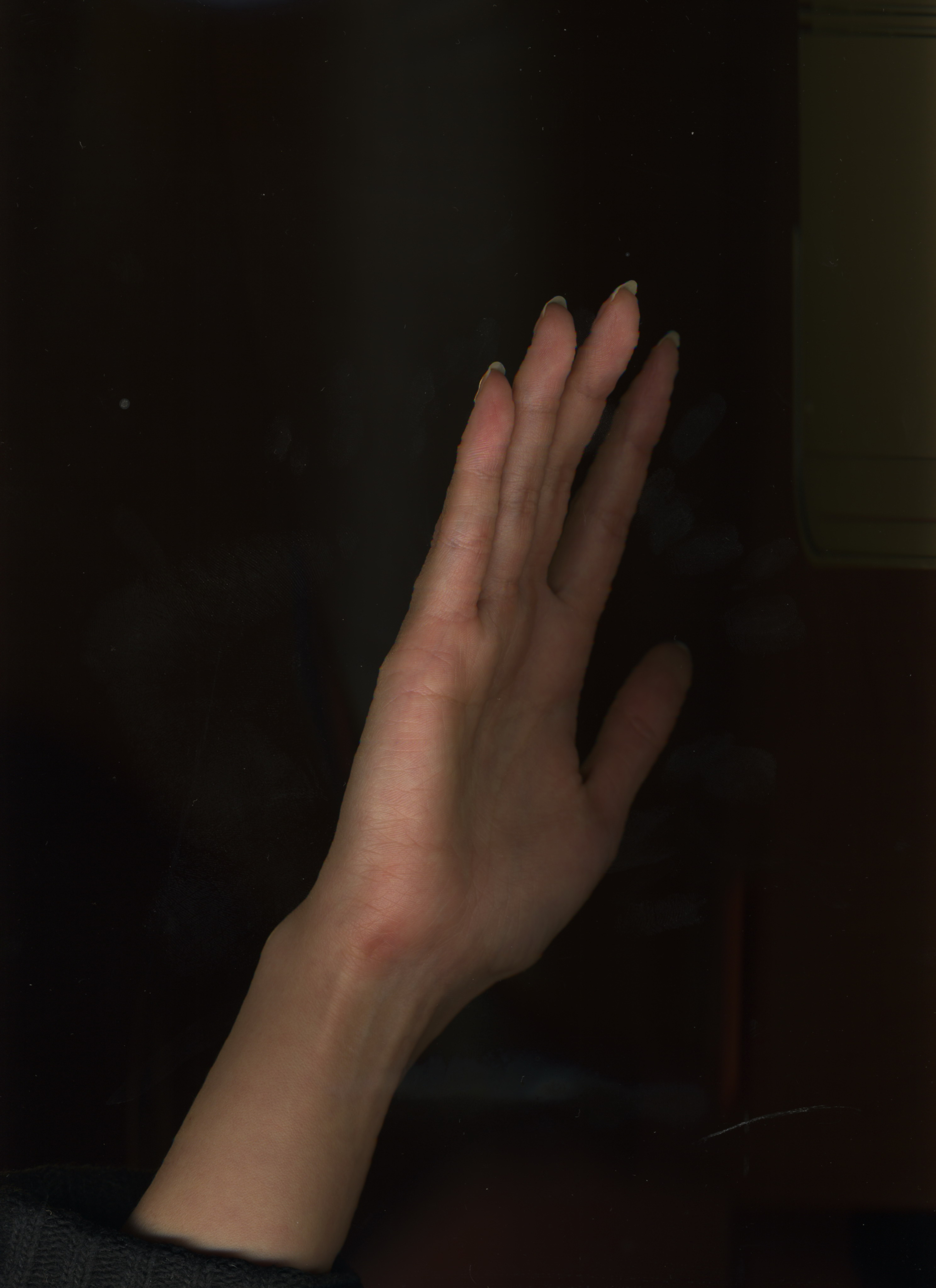 правое ребро.JPG